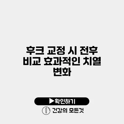 후크 교정 시 전후 비교 효과적인 치열 변화